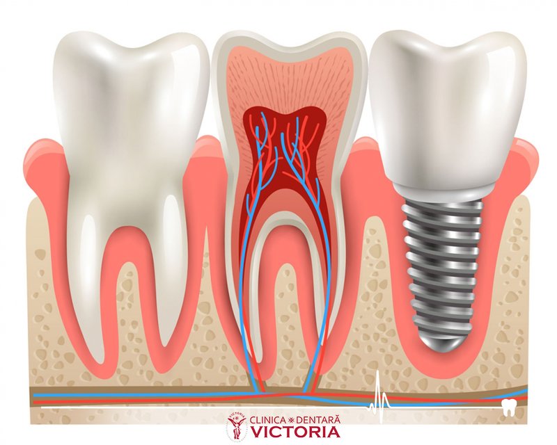 Upgrade Dental - Clinica stomatologica