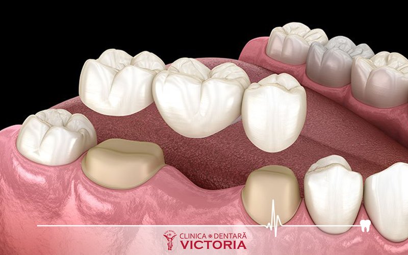 Upgrade Dental - Clinica stomatologica