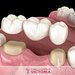 Upgrade Dental - Clinica stomatologica